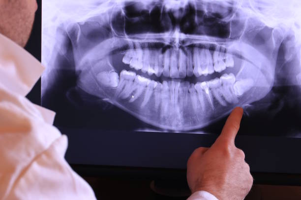 Best Emergency Tooth Extraction in Gridley, IL