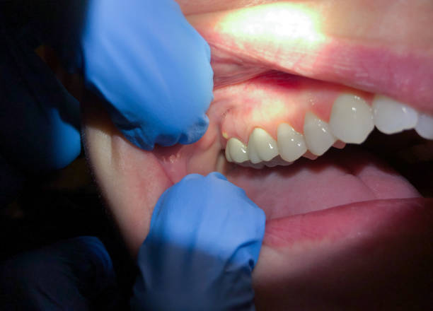 Best Cosmetic Emergency Dentistry in Gridley, IL