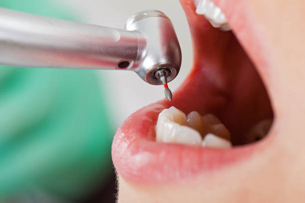 Best Weekend Emergency Dentist in Gridley, IL